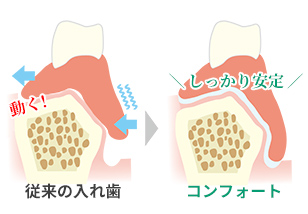 3. 高い封鎖性と安定力