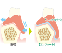 お口の中で安定して外れにくいのイラスト