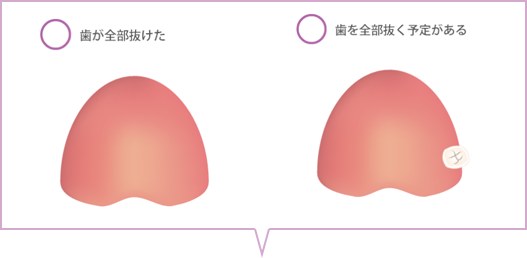 歯が全部抜けた、歯を全部抜く予定があるのイラスト