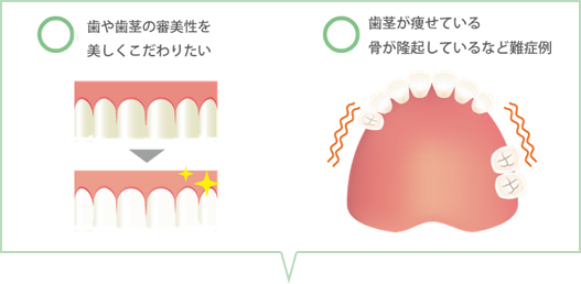 歯や歯茎の審美性を美しくこだわりたい、歯茎が痩せている、骨が隆起しているなどの何症例のイラスト